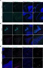 Rabbit IgG (H+L) Highly Cross-Adsorbed Secondary Antibody in Immunocytochemistry (ICC/IF)