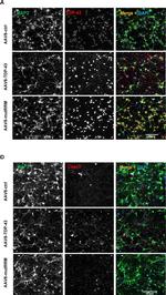 Mouse IgG (H+L) Highly Cross-Adsorbed Secondary Antibody in Immunocytochemistry (ICC/IF)