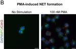 Goat IgG (H+L) Cross-Adsorbed Secondary Antibody in Immunocytochemistry (ICC/IF)