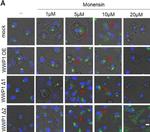 Rabbit IgG (H+L) Cross-Adsorbed Secondary Antibody in Immunocytochemistry (ICC/IF)
