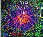 Mouse IgG (H+L) Cross-Adsorbed Secondary Antibody in Immunocytochemistry (ICC/IF)