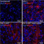 Mouse IgG (H+L) Cross-Adsorbed Secondary Antibody in Immunocytochemistry (ICC/IF)