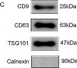 Rabbit IgG (H+L) Secondary Antibody in Western Blot (WB)