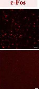 Rabbit IgG (H+L) Highly Cross-Adsorbed Secondary Antibody in Immunohistochemistry (Frozen) (IHC (F))