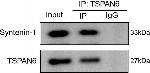 Rabbit IgG (H+L) Secondary Antibody in Immunoprecipitation (IP)