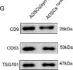Rabbit IgG (H+L) Secondary Antibody in Western Blot (WB)