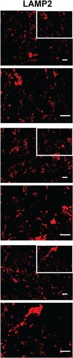 Mouse IgG (H+L) Cross-Adsorbed Secondary Antibody in Immunocytochemistry (ICC/IF)