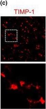 Mouse IgG (H+L) Cross-Adsorbed Secondary Antibody in Immunohistochemistry (Paraffin) (IHC (P))
