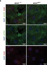 Rabbit IgG (H+L) Cross-Adsorbed Secondary Antibody in Immunocytochemistry (ICC/IF)