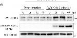 Rabbit IgG (H+L) Secondary Antibody in Western Blot (WB)