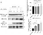 Rabbit IgG (H+L) Secondary Antibody in Western Blot (WB)