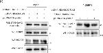 Rabbit IgG (H+L) Secondary Antibody in Western Blot (WB)