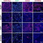 Rabbit IgG (H+L) Highly Cross-Adsorbed Secondary Antibody in Immunocytochemistry (ICC/IF)