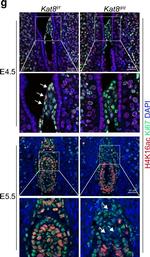 Rabbit IgG (H+L) Highly Cross-Adsorbed Secondary Antibody in Immunocytochemistry (ICC/IF)