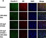 Rabbit IgG (H+L) Highly Cross-Adsorbed Secondary Antibody in Immunocytochemistry (ICC/IF)