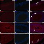Rabbit IgG (H+L) Secondary Antibody in Immunohistochemistry (Paraffin) (IHC (P))