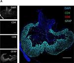 Rabbit IgG (H+L) Cross-Adsorbed Secondary Antibody in Immunohistochemistry (IHC)