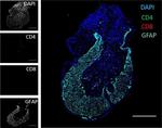 Rabbit IgG (H+L) Cross-Adsorbed Secondary Antibody in Immunohistochemistry (IHC)
