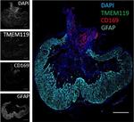 Chicken IgY (H+L) Secondary Antibody in Immunohistochemistry (IHC)
