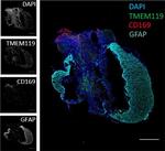 Mouse IgG (H+L) Cross-Adsorbed Secondary Antibody in Immunohistochemistry (IHC)