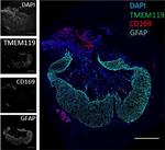 Mouse IgG (H+L) Cross-Adsorbed Secondary Antibody in Immunohistochemistry (IHC)
