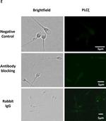 Rabbit IgG (H+L) Cross-Adsorbed Secondary Antibody in Immunocytochemistry (ICC/IF)