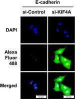 Rabbit IgG (H+L) Highly Cross-Adsorbed Secondary Antibody in Immunocytochemistry (ICC/IF)