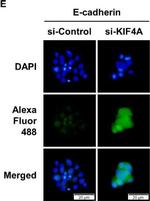 Rabbit IgG (H+L) Highly Cross-Adsorbed Secondary Antibody in Immunocytochemistry (ICC/IF)