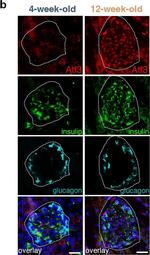 Rabbit IgG (H+L) Highly Cross-Adsorbed Secondary Antibody in Immunohistochemistry (Frozen) (IHC (F))