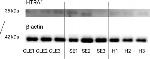 Rabbit IgG (H+L) Cross-Adsorbed Secondary Antibody in Western Blot (WB)