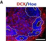 Goat IgG (H+L) Cross-Adsorbed Secondary Antibody in Immunohistochemistry (Frozen) (IHC (F))