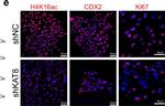 Rabbit IgG (H+L) Highly Cross-Adsorbed Secondary Antibody in Immunocytochemistry (ICC/IF)