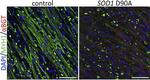 Mouse IgG (H+L) Highly Cross-Adsorbed Secondary Antibody in Immunocytochemistry (ICC/IF)