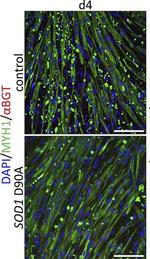 Mouse IgG (H+L) Highly Cross-Adsorbed Secondary Antibody in Immunocytochemistry (ICC/IF)