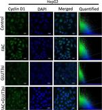 Rabbit IgG (H+L) Cross-Adsorbed Secondary Antibody in Immunocytochemistry (ICC/IF)