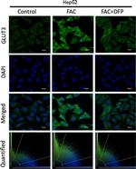 Rabbit IgG (H+L) Cross-Adsorbed Secondary Antibody in Immunocytochemistry (ICC/IF)