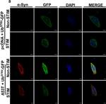 Rabbit IgG (H+L) Cross-Adsorbed Secondary Antibody in Immunocytochemistry (ICC/IF)