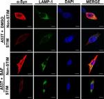 Rabbit IgG (H+L) Cross-Adsorbed Secondary Antibody in Immunocytochemistry (ICC/IF)