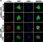 Mouse IgG (H+L) Highly Cross-Adsorbed Secondary Antibody in Immunocytochemistry (ICC/IF)