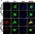Mouse IgG (H+L) Highly Cross-Adsorbed Secondary Antibody in Immunocytochemistry (ICC/IF)