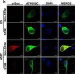 Mouse IgG (H+L) Highly Cross-Adsorbed Secondary Antibody in Immunocytochemistry (ICC/IF)
