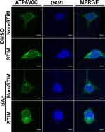 Rabbit IgG (H+L) Cross-Adsorbed Secondary Antibody in Immunocytochemistry (ICC/IF)