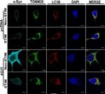 Rabbit IgG (H+L) Cross-Adsorbed Secondary Antibody in Immunocytochemistry (ICC/IF)