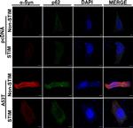 Rabbit IgG (H+L) Cross-Adsorbed Secondary Antibody in Immunocytochemistry (ICC/IF)