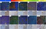 Mouse IgG1 Cross-Adsorbed Secondary Antibody in Immunohistochemistry (IHC)