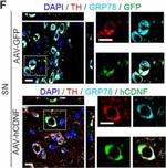 Mouse IgG (H+L) Highly Cross-Adsorbed Secondary Antibody in Immunohistochemistry (Frozen) (IHC (F))