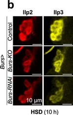 Mouse IgG (H+L) Highly Cross-Adsorbed Secondary Antibody in Immunohistochemistry (IHC)