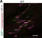 Chicken IgY (H+L) Secondary Antibody in Immunohistochemistry (IHC)