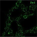 Rabbit IgG (H+L) Cross-Adsorbed Secondary Antibody in Immunocytochemistry (ICC/IF)
