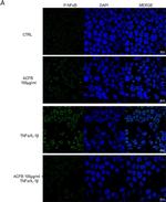 Rabbit IgG (H+L) Cross-Adsorbed Secondary Antibody in Immunocytochemistry (ICC/IF)